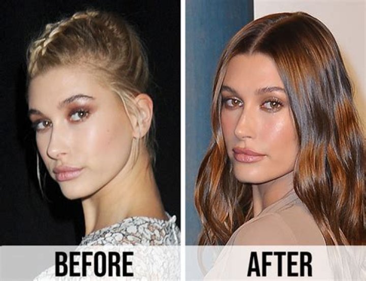 See How Hailey Davidson Transformed Before Surgery: A Visual Journey